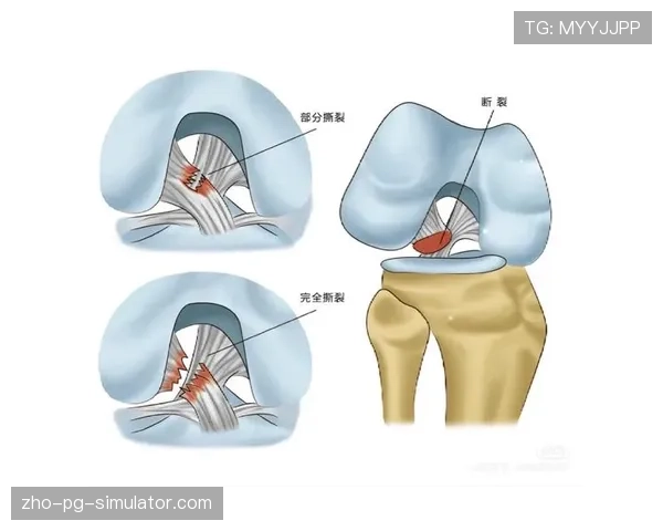 塞尔吉-卡诺斯十字韧带损伤，瓦伦西亚边路突破能力受损